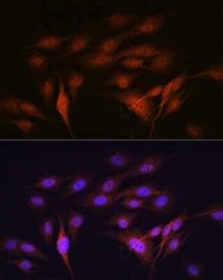 LXR alpha/NR1H3 Rabbit anti-Human, Mouse, Rat, Clone: 7Z4H10, Novus Biologicals:Antibodies:Primary