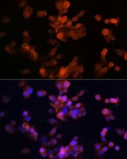 LXR alpha/NR1H3 Rabbit anti-Human, Mouse, Rat, Clone: 7Z4H10, Novus Biologicals:Antibodies:Primary