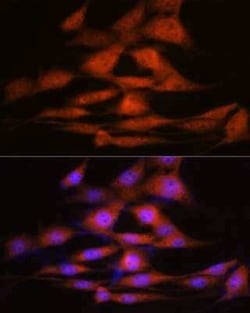 LXR alpha/NR1H3 Rabbit anti-Human, Mouse, Rat, Clone: 7Z4H10, Novus Biologicals:Antibodies:Primary