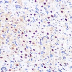 LXR alpha/NR1H3 Rabbit anti-Human, Mouse, Rat, Clone: 7Z4H10, Novus Biologicals:Antibodies:Primary