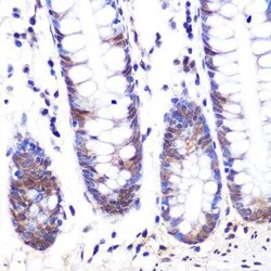 LXR alpha/NR1H3 Rabbit anti-Human, Mouse, Rat, Clone: 7Z4H10, Novus Biologicals:Antibodies:Primary
