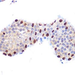 LXR alpha/NR1H3 Rabbit anti-Human, Mouse, Rat, Clone: 7Z4H10, Novus Biologicals:Antibodies:Primary