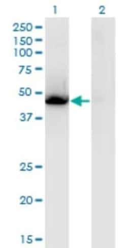 LXR alpha/NR1H3 Antibody (3E9), Novus Biologicals 0.1 mg | Buy Online | Novus Biologicals | Fisher Scientific