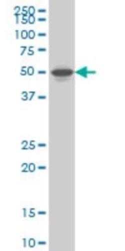 Novus Biologicals LXR beta/NR1H2 Antibody (1B6), Novus Biologicals 0.1 mg | Buy Online | Novus Biologicals&trade; | Fisher Scientific