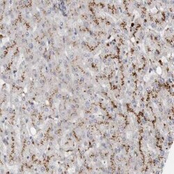 LYAG/GAA Antibody, Novus Biologicals:Antibodies:Primary Antibodies