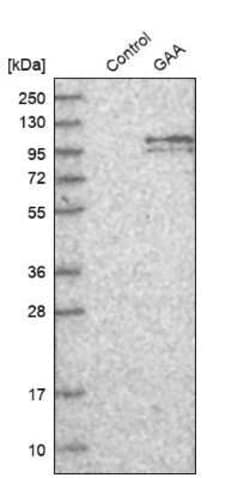 LYAG/GAA Antibody, Novus Biologicals:Antibodies:Primary Antibodies
