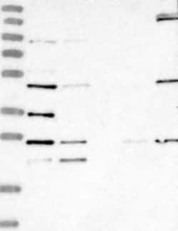 LYAR Rabbit anti-Human, Polyclonal, Novus Biologicals 25 &mu;g; Unconjugated:Antibodies,