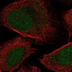 LYPD1 Rabbit anti-Human, Polyclonal, Novus Biologicals:Antibodies:Primary