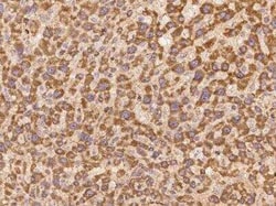 LYPD2 Antibody, Novus Biologicals:Antibodies:Primary Antibodies