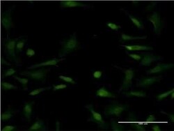 LYPLA1 Antibody (3D5), Novus Biologicals 0.1 mg | Buy Online | Novus Biologicals | Fisher Scientific