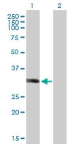 LYSMD2 Antibody, Novus Biologicals 0.05 mg | Buy Online | Novus Biologicals | Fisher Scientific
