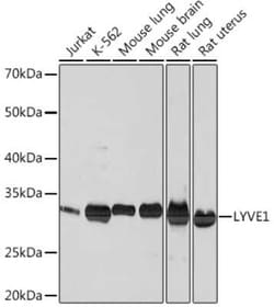 LYVE-1 Rabbit anti-Human, Mouse, Rat, Clone: 4G7C3, Novus Biologicals 100