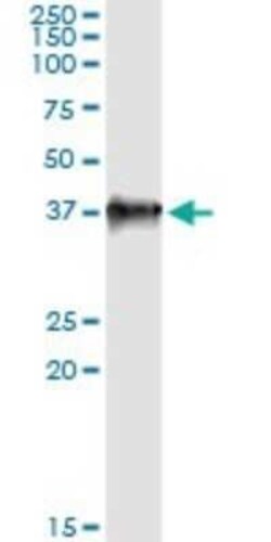 LZTFL1 Antibody (1B1), Novus Biologicals 0.1 mg | Buy Online | Novus Biologicals | Fisher Scientific