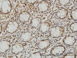 LZTFL1 Antibody (7F6), Novus Biologicals 0.1 mg | Buy Online | Novus Biologicals | Fisher Scientific