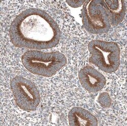 LZTR1 Antibody, Novus Biologicals:Antibodies:Primary Antibodies