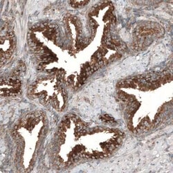 LZTR1 Antibody, Novus Biologicals:Antibodies:Primary Antibodies