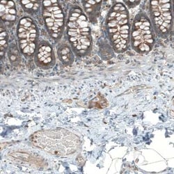 LZTR1 Antibody, Novus Biologicals:Antibodies:Primary Antibodies
