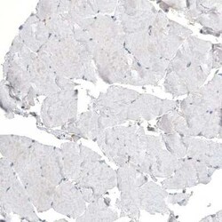 LZTR1 Antibody, Novus Biologicals:Antibodies:Primary Antibodies