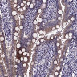 LZTR2 Antibody, Novus Biologicals:Antibodies:Primary Antibodies