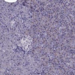 LZTR2 Antibody, Novus Biologicals:Antibodies:Primary Antibodies