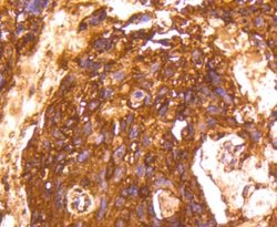 Lactate Dehydrogenase A/LDHA Antibody (SU39-06), Novus Biologicals 100&mu;L:Antibodies,