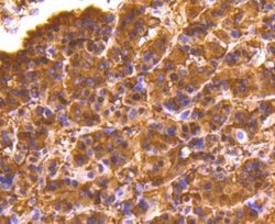 Lactate Dehydrogenase A/LDHA Antibody (SU39-06), Novus Biologicals 100&mu;L:Antibodies,