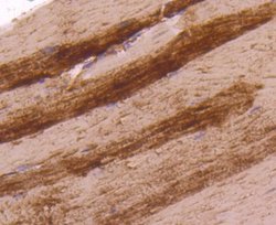 Lactate Dehydrogenase A/LDHA Antibody (SU39-06), Novus Biologicals 100&mu;L:Antibodies,