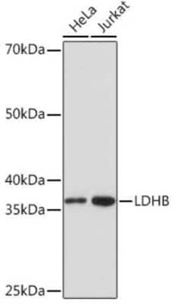 Lactate Dehydrogenase B Rabbit anti-Human, Rat, Clone: 6B5I2, Novus Biologicals 20 &mu;g | Buy Online | Novus Biologicals | Fisher Scientific