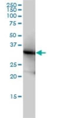 Lactate Dehydrogenase B Antibody (2H6), Novus Biologicals 0.1 mg | Buy Online | Novus Biologicals | Fisher Scientific