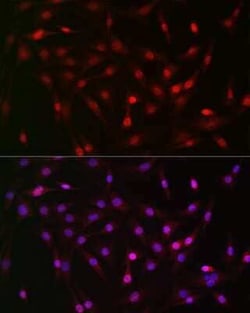 Lactyl-Lysine Rabbit anti-Human, Mouse, Rat, Polyclonal, Novus Biologicals