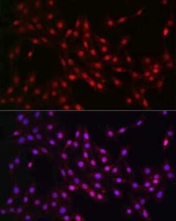Lactyl-Lysine Rabbit anti-Human, Mouse, Rat, Polyclonal, Novus Biologicals