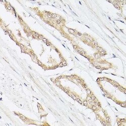 Lactyl-Lysine Rabbit anti-Human, Mouse, Rat, Polyclonal, Novus Biologicals