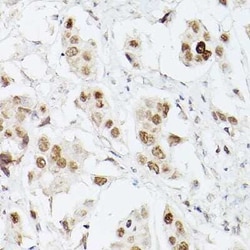 Lactyl-Lysine Rabbit anti-Human, Mouse, Rat, Polyclonal, Novus Biologicals