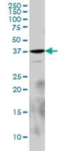Laforin/EPM2A Antibody (6C6), Novus Biologicals 0.1 mg | Buy Online | Novus Biologicals | Fisher Scientific