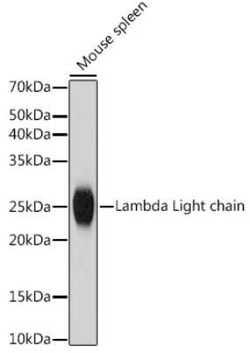 Lambda Light Chain Rabbit anti-Human, Mouse, Rat, Clone: 1R9H8, Novus Biologicals 100 &mu;g | Buy Online | Novus Biologicals | Fisher Scientific