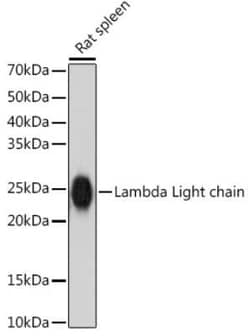 Lambda Light Chain Rabbit anti-Human, Mouse, Rat, Clone: 1R9H8, Novus Biologicals 100 &mu;g | Buy Online | Novus Biologicals | Fisher Scientific