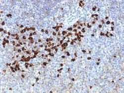 Lambda Light Chain Antibody (LLC/1738), Novus Biologicals 20&mu;g; Unlabeled:Antibodies,