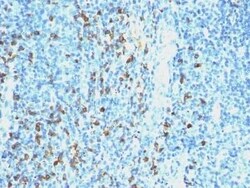 Lambda Light Chain Antibody (SPM559), Novus Biologicals 0.02 mg; Unconjugated:Antikörper