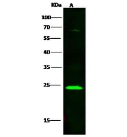 Lambda5/IGLL1 Antibody, Novus Biologicals 50 &mu;g, Unconjugated:Anticuerpos