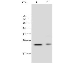Lambda5/IGLL1 Antibody, Novus Biologicals:Antibodies:Primary Antibodies