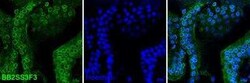 Lamin B Receptor Antibody (BB2SS3F3), Novus Biologicals 0.025 mg; Unconjugated:Antibodies,