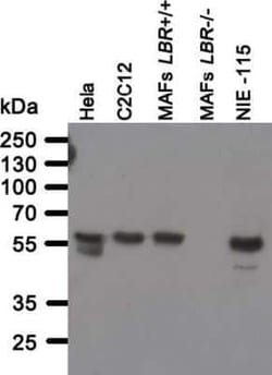 Lamin B Receptor Antibody (BB2SS3F3), Novus Biologicals 0.025 mg; Unconjugated:Antibodies,