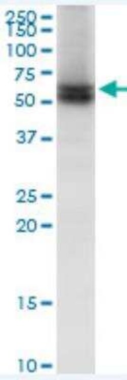 Lamin B Receptor Antibody, Novus Biologicals 0.05 mg | Buy Online | Novus Biologicals | Fisher Scientific