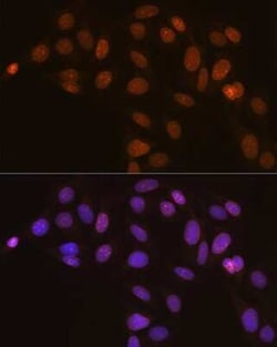 Lamin B2 Rabbit anti-Human, Mouse, Rat, Clone: 1S9M6, Novus Biologicals