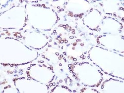 Lamin B2 Rabbit anti-Human, Mouse, Rat, Clone: 1S9M6, Novus Biologicals