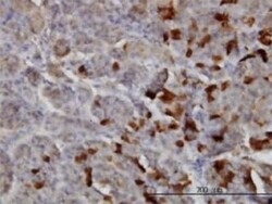 Laminin alpha 2 Antibody (2D4), Novus Biologicals 50 &mu;g | Buy Online | Novus Biologicals | Fisher Scientific