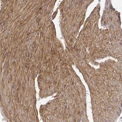 Laminin alpha 4 Antibody, Novus Biologicals 25 &mu;L; Unconjugated:Antibodies,