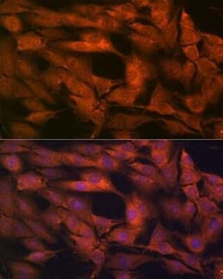 Laminin beta 1 Rabbit anti-Human, Mouse, Rat, Clone: 6I9T4, Novus Biologicals:Antibodies:Primary