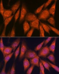 Laminin beta 1 Rabbit anti-Human, Mouse, Rat, Clone: 6I9T4, Novus Biologicals:Antibodies:Primary