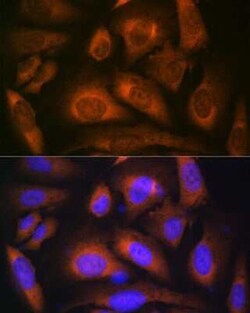 Laminin beta 1 Rabbit anti-Human, Mouse, Rat, Clone: 6I9T4, Novus Biologicals:Antibodies:Primary